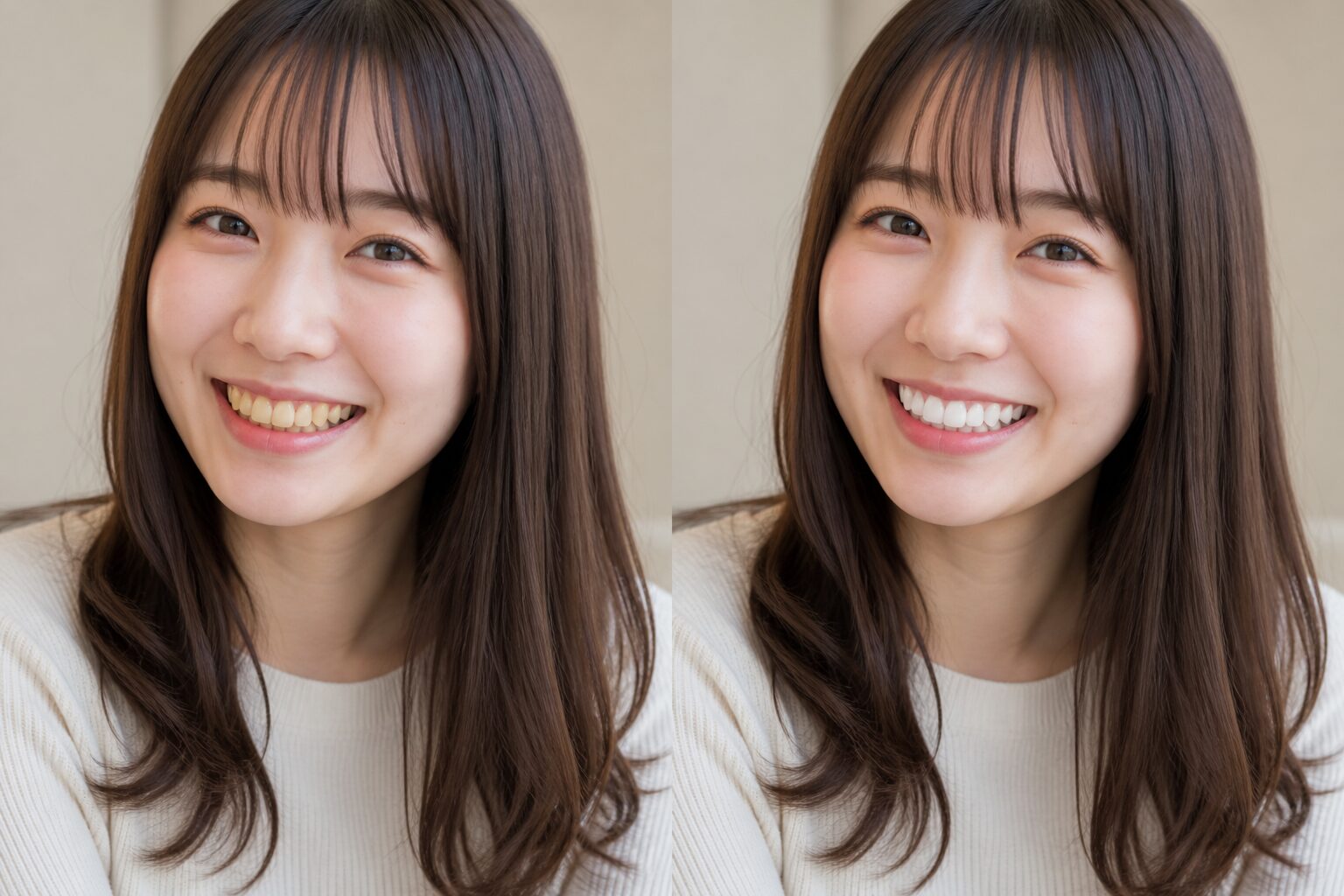 歯の色で印象が変わる比較画像Before黄ばみAfter白い歯